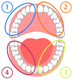 従来の歯周治療